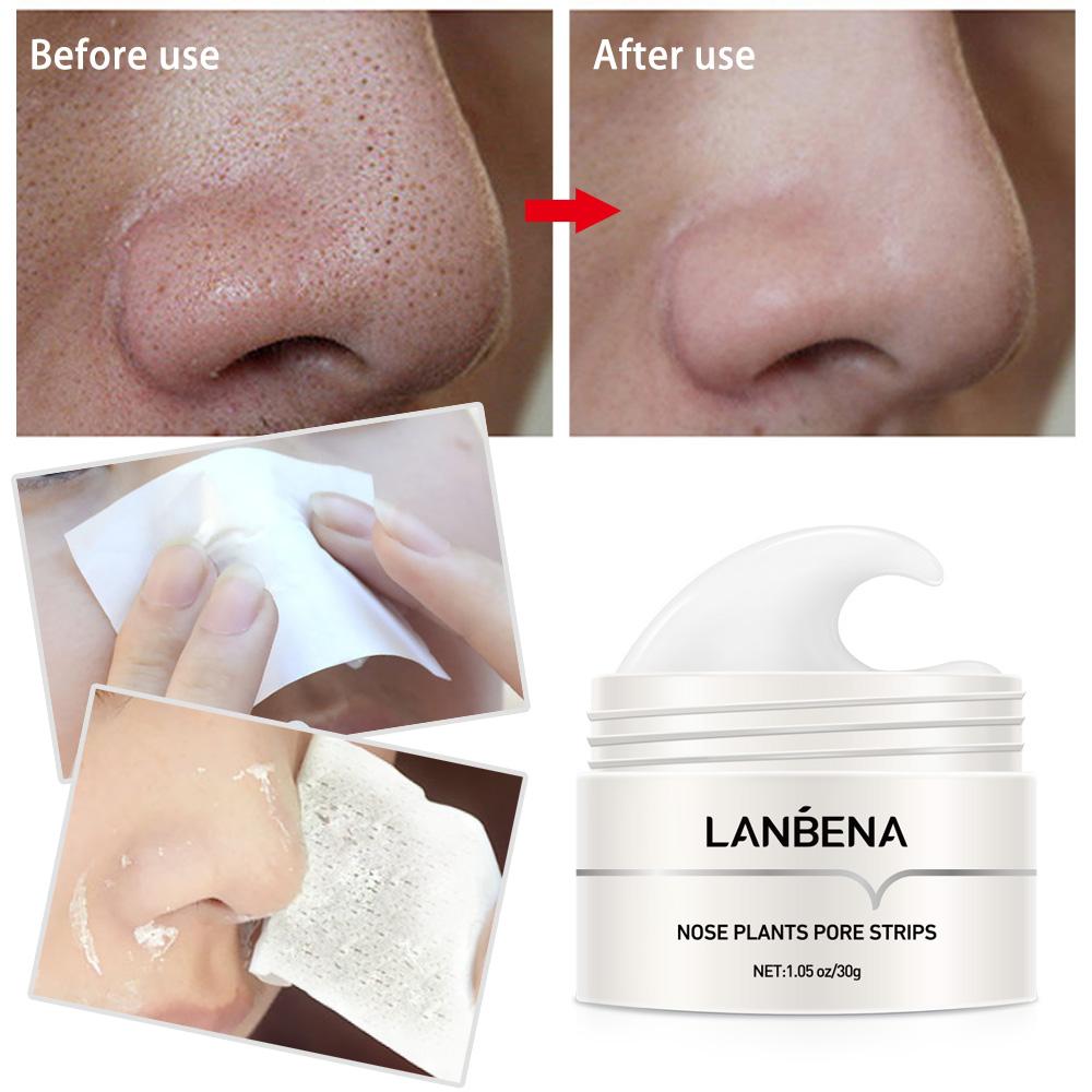 Lanbena pore strips