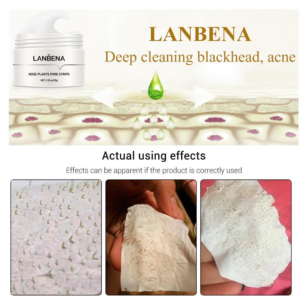 Lanbena pore strips